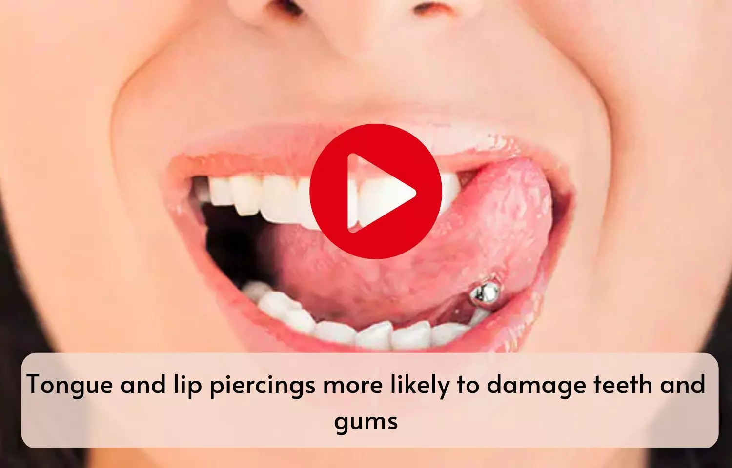Tongue and lip piercings more likely to damage teeth and gums