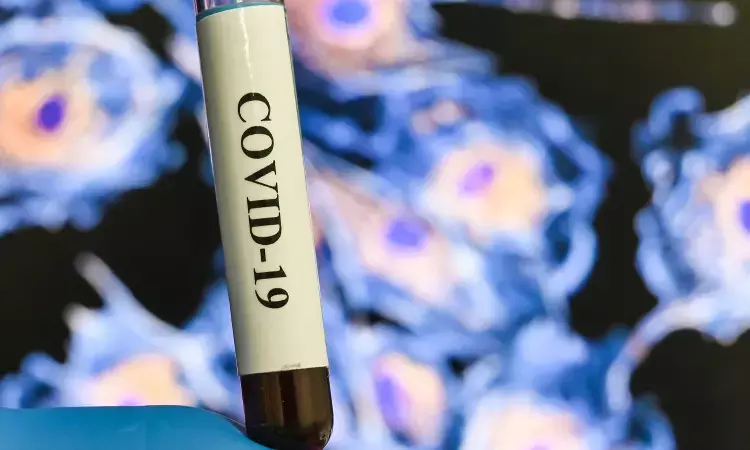 New antibody detection method for coronavirus that does not require a blood sample