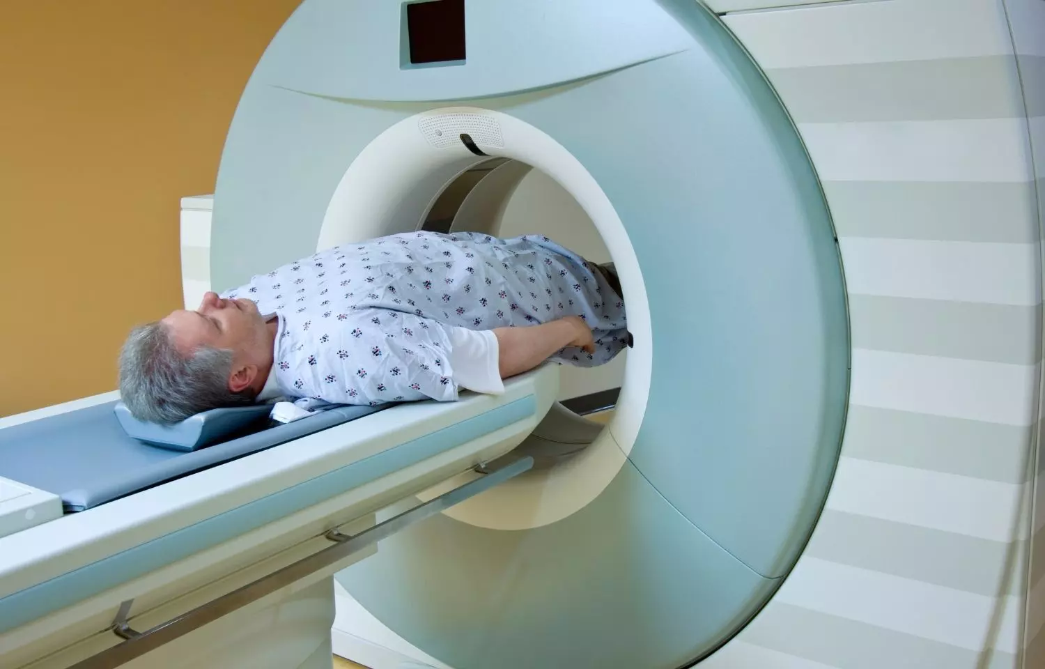 The super-fast MRI scan that could revolutionise heart failure diagnosis