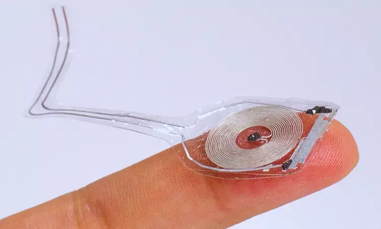 Dissolving implantable device relieves pain on demand and without use of drugs.