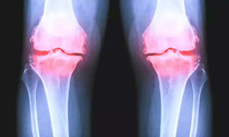 Are Weight-Bearing Knee Digital Radiographs better for assessment of Severity of OA?