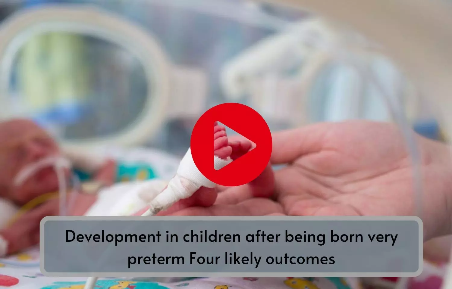 Development in children after being born very preterm Four likely outcomes