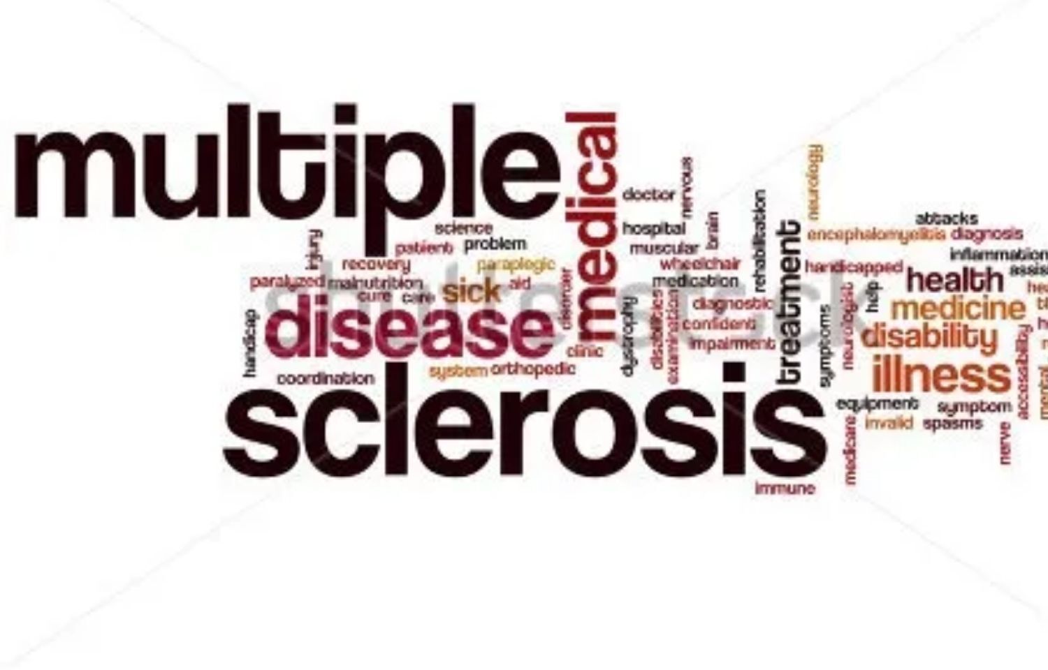 Latitude and UVB exposure linked to multiple sclerosis severity: study