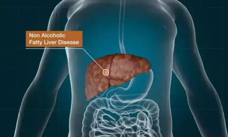 Ethyl glucuronide in the hair can accurately detect harmful alcohol consumption in NAFLD