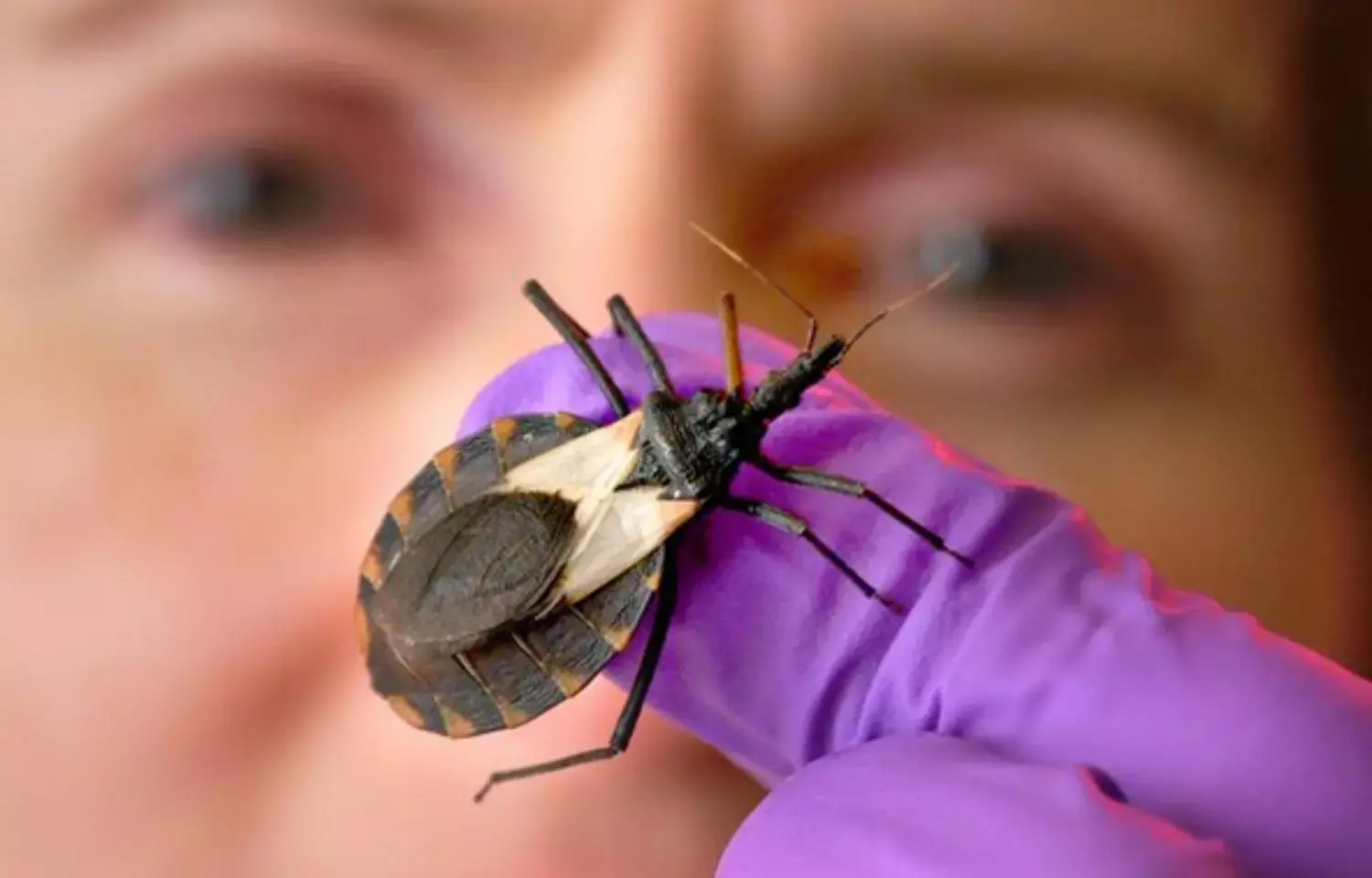 CMR reveals myocardial injury  in patients with Chagas disease for first time