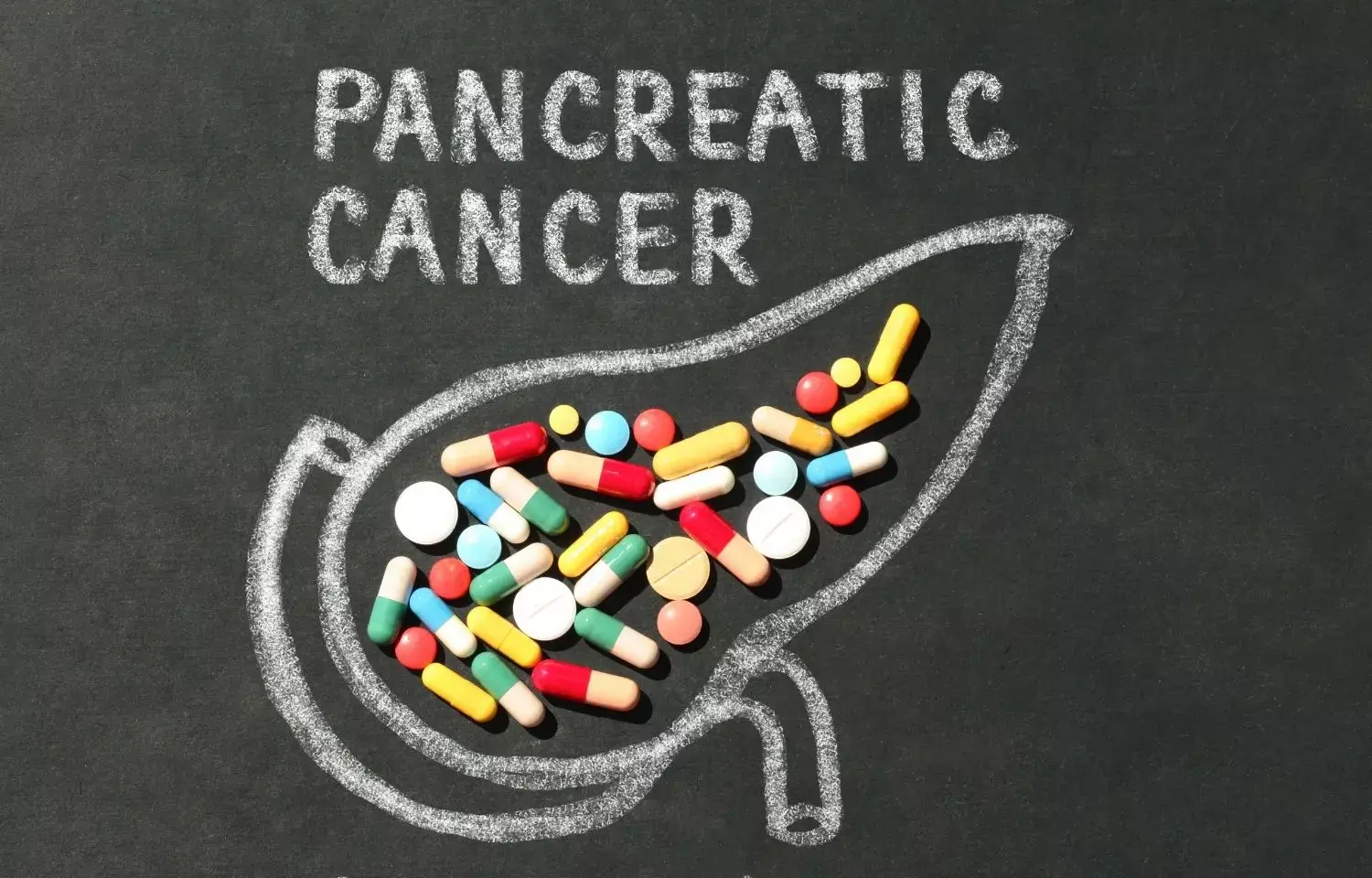 High insulin levels directly linked to pancreatic cancer