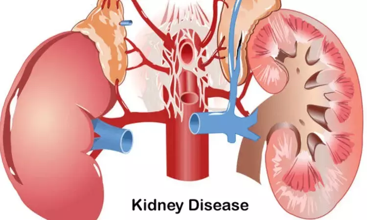 Higher physical activity may lower risk of heart disease in adults with chronic kidney disease