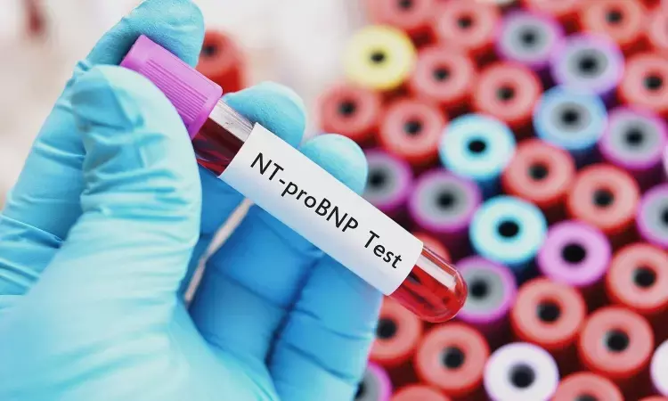 NT-proBNP levels predict mortality in patients with acute decompensated and de novo heart failure: Study