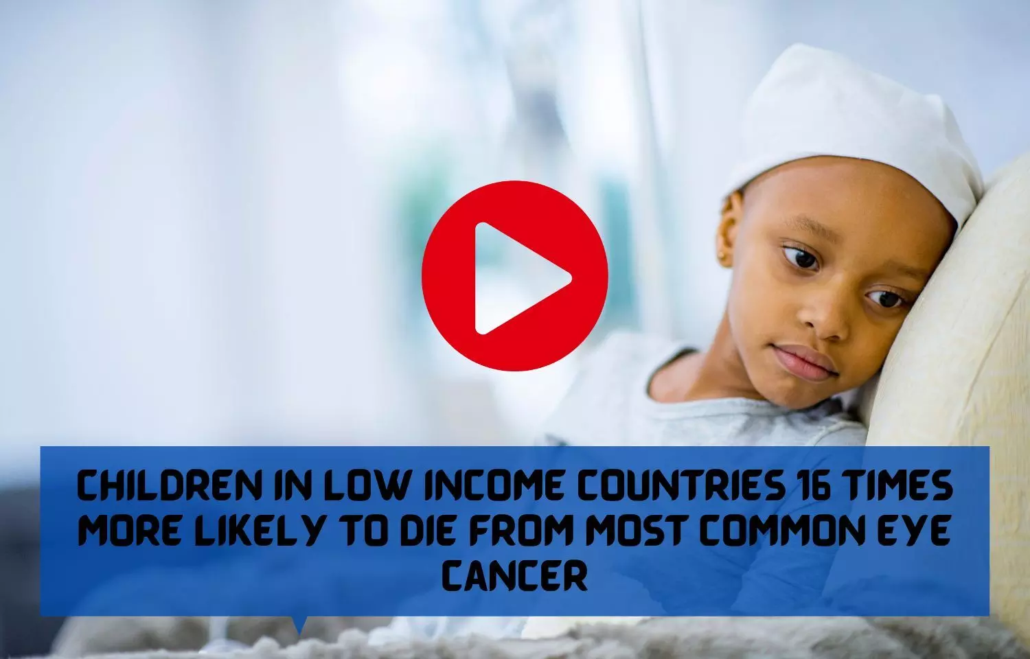 Children in low income countries 16 times more likely to die from most common eye cancer