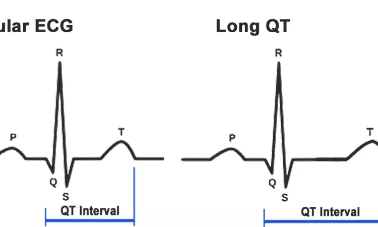 Provocative testing useful for diagnosis of congenital long QT syndrome: JAHA