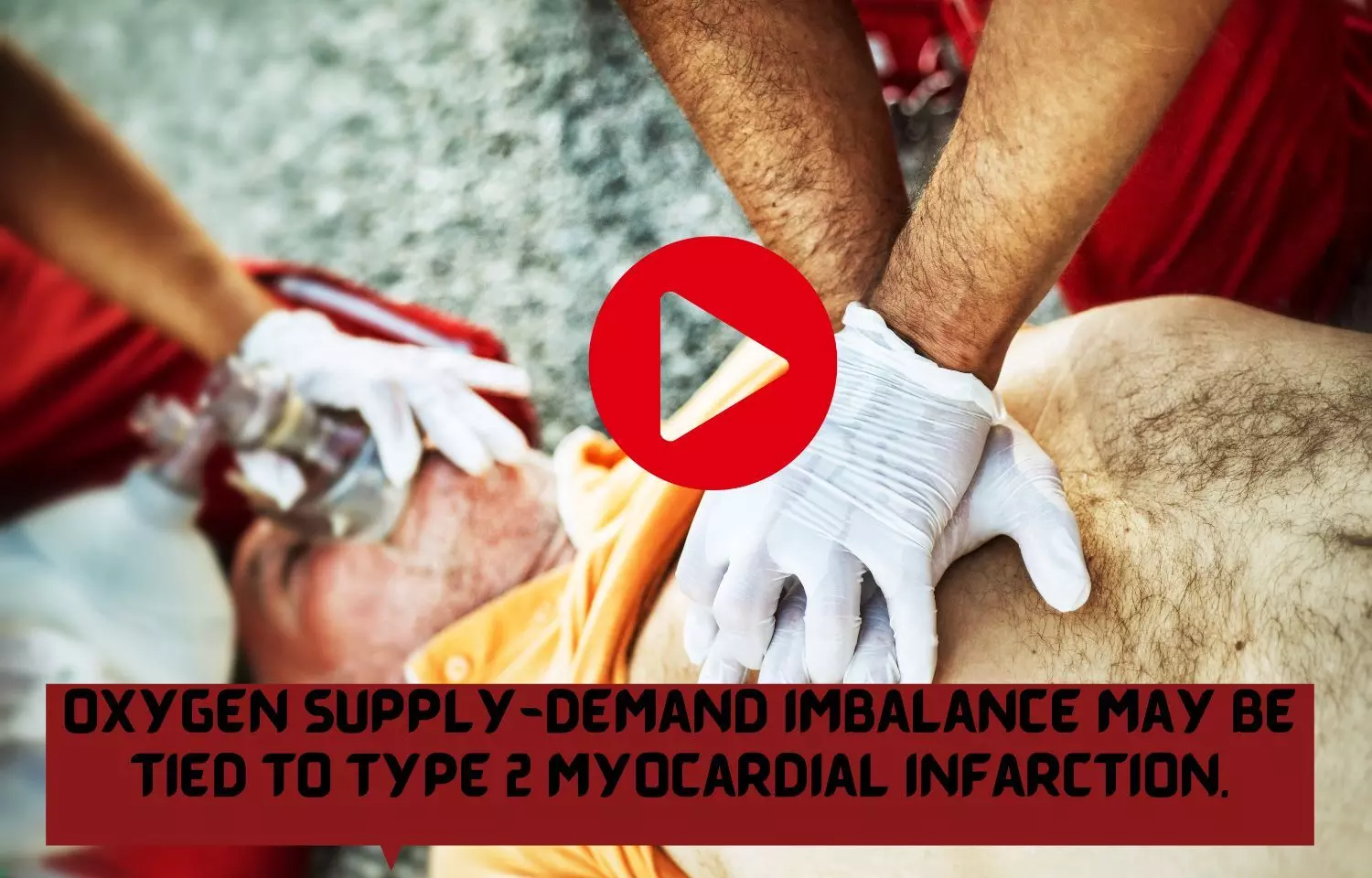 Oxygen Supply-Demand Imbalance may be tied to Type 2 Myocardial Infarction
