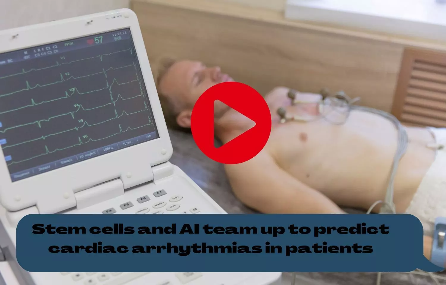 Stem cells and AI team up to predict cardiac arrhythmias in patients