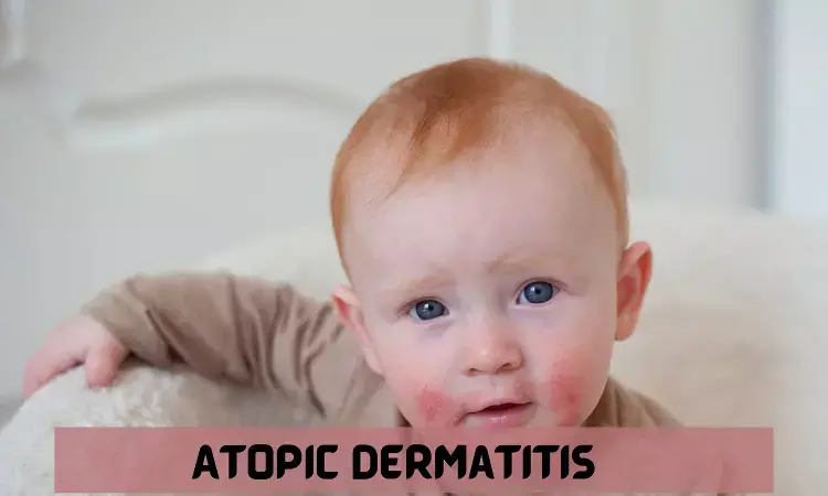 Dupilumab highly effective in reducing symptoms of eczema in children less than 6 years