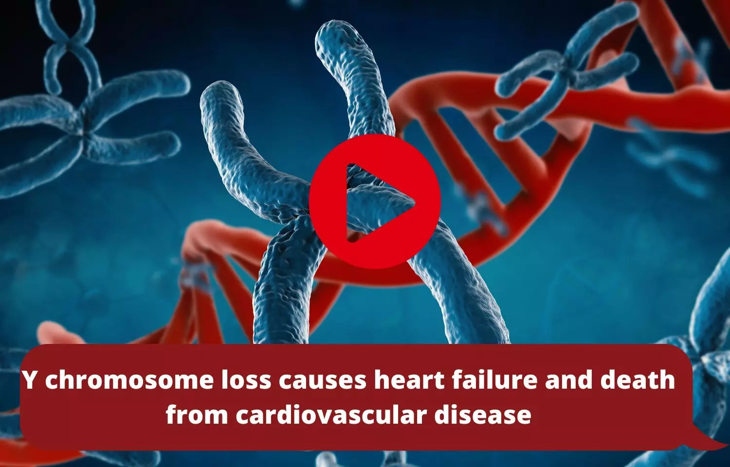 Y chromosome loss causes heart failure and death from cardiovascular disease