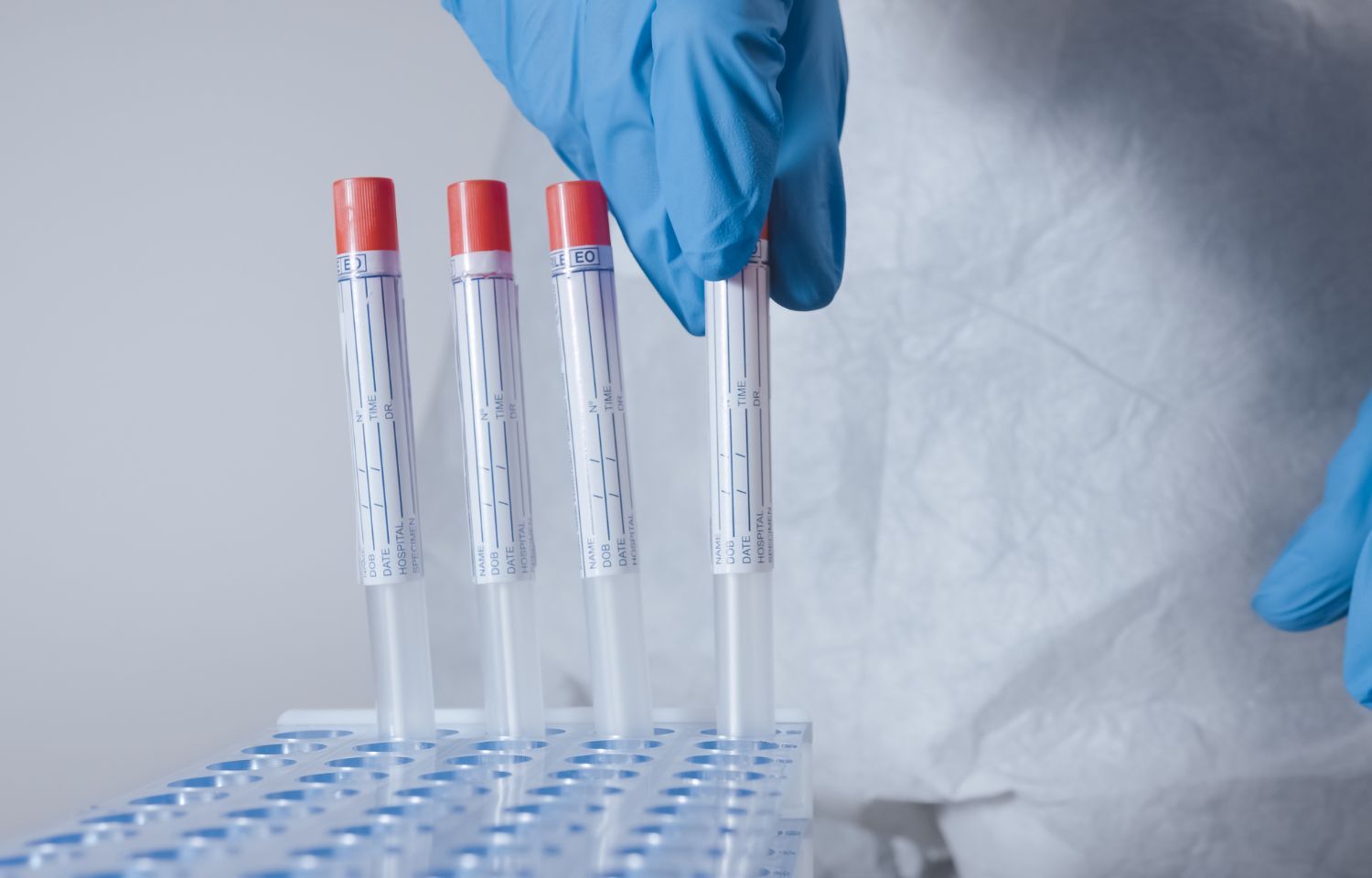 molbio-diagnostics-unveils-truenat-mtb-inh-test-for-drug-resistance-in