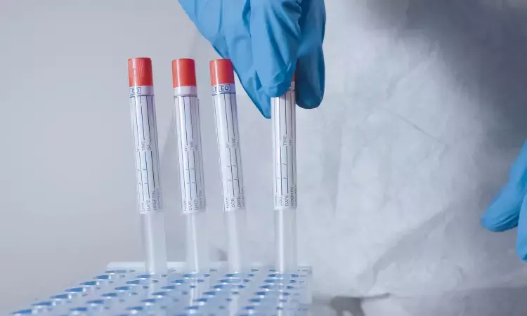 Mylab Discovery Solutions unveils combined RT-PCR test kit for chikungunya, dengue, malaria