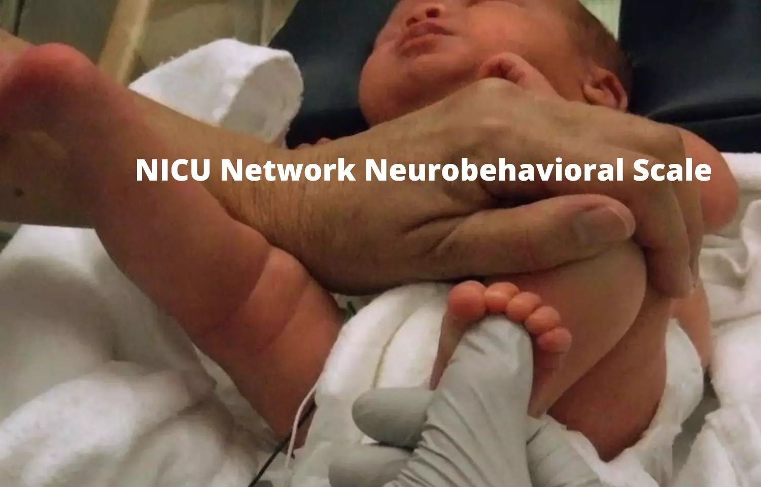 Neonatal neurobehavioral patterns help in predicting cognitive and motor delays in toddlers: JAMA