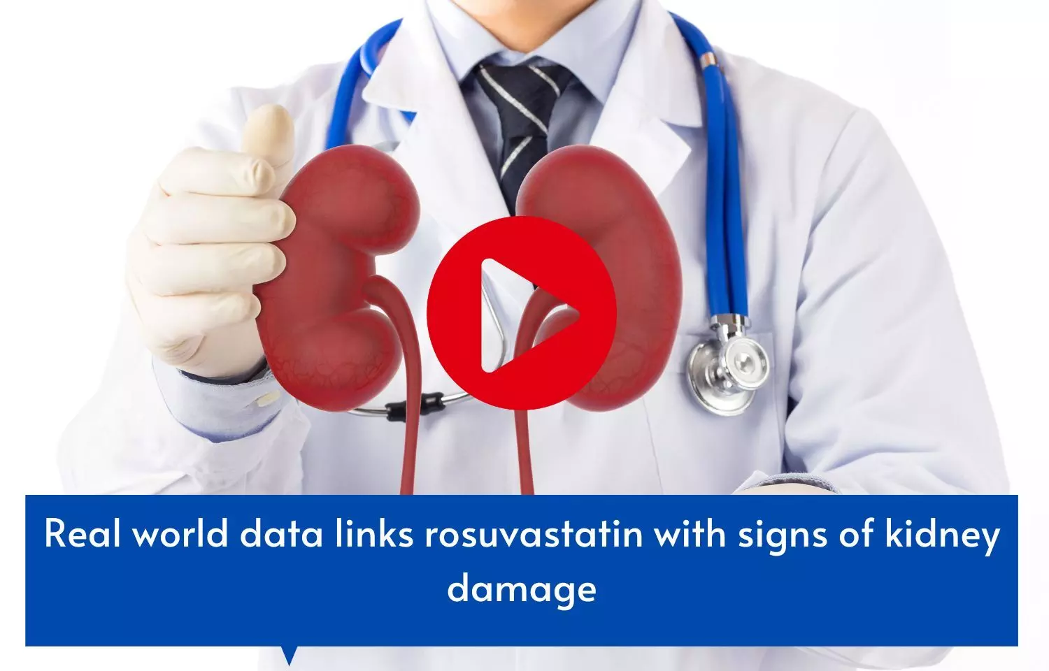 Real world data links rosuvastatin with signs of kidney damage