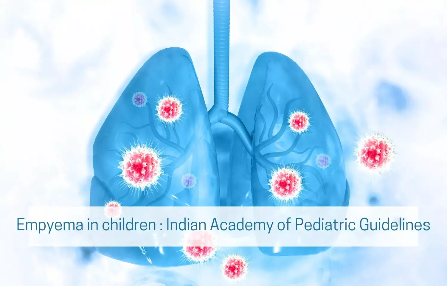 Empyema in Children: Indian Academy of Pediatrics Guidelines