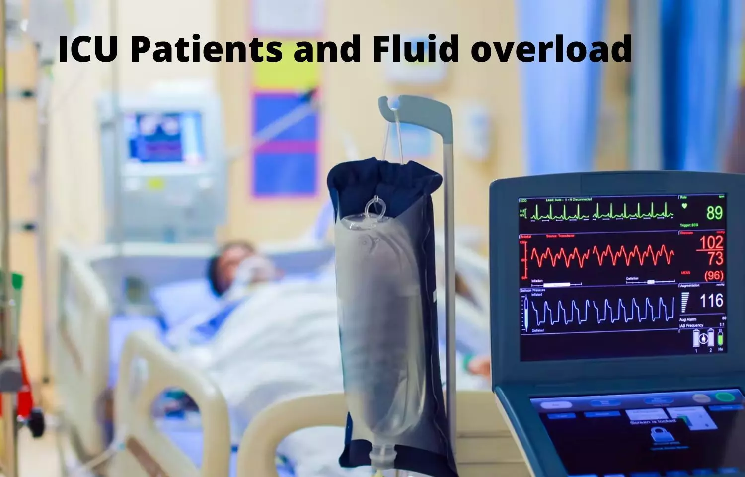 Do loop diuretics reduce mortality in ICU patients with fluid overload?