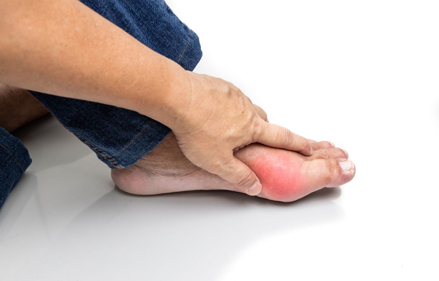 Alcohol Consumption Tied To Tophi Development In Gout Patients Study