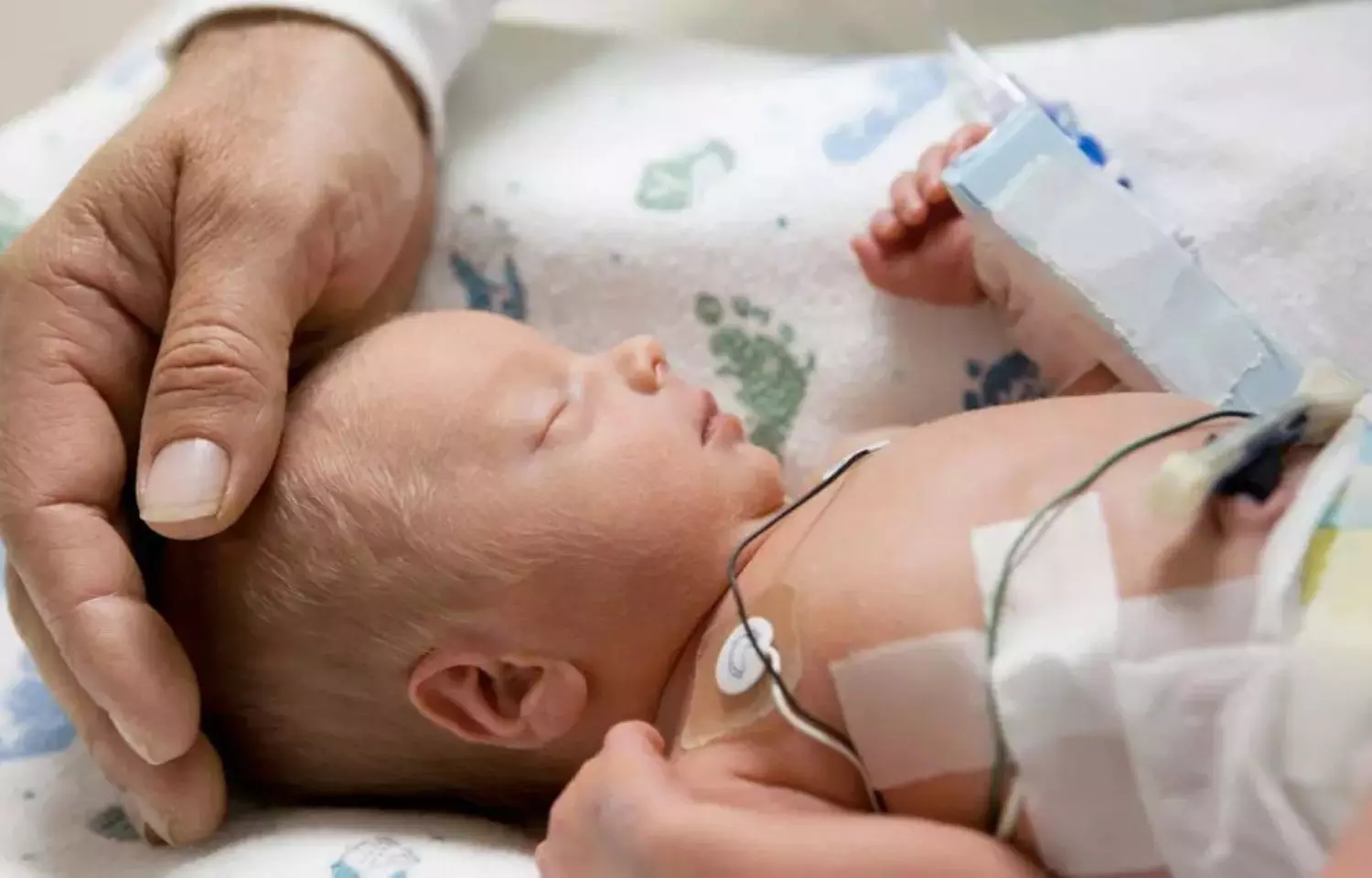 Preterm birth more likely with exposure to phthalates, find JAMA study