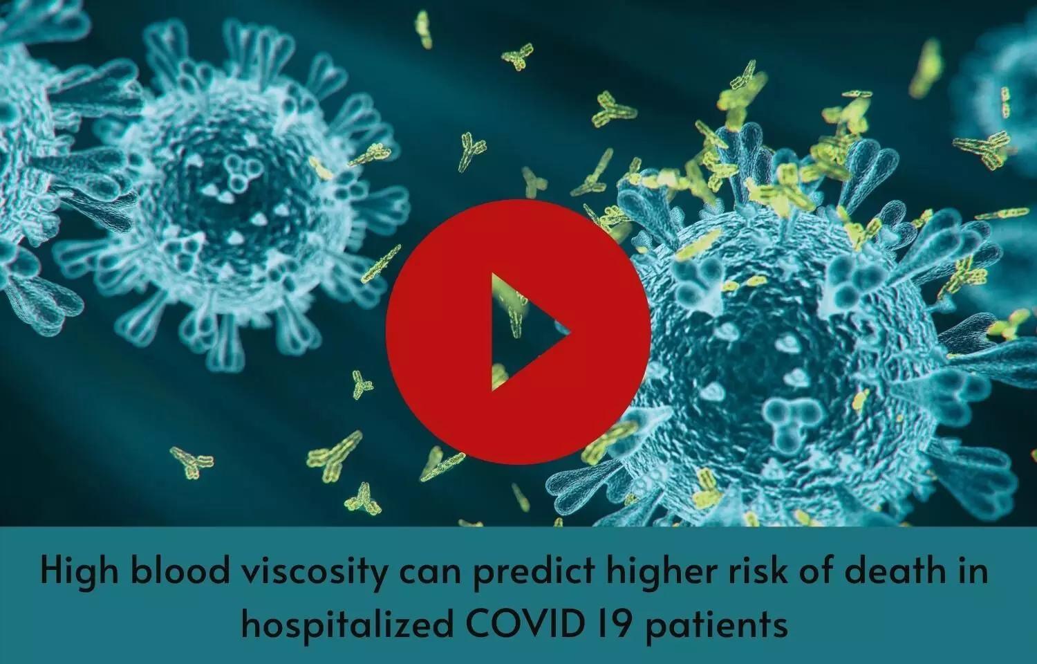High blood viscosity can predict higher risk of death in hospitalized COVID 19 patients