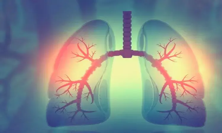 New model may assess and stratify lung cancer risk in female non-smokers