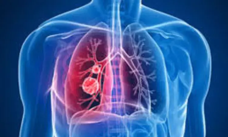 Endobronchial valve therapy for emphysema improves lung function and quality of life,  finds research