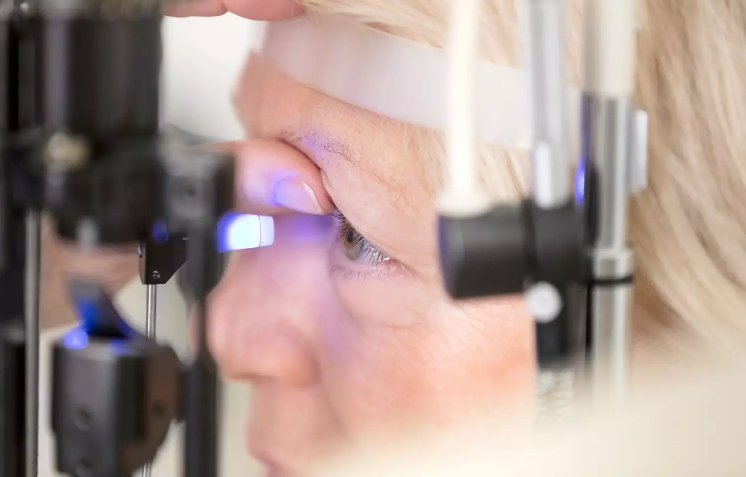 Black patients found six times more likely to have advanced vision loss after glaucoma diagnosis than white patients