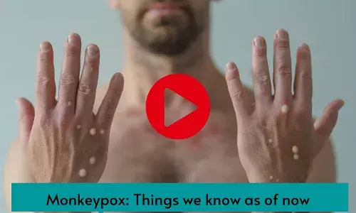 Monkeypox: Things we know as of now
