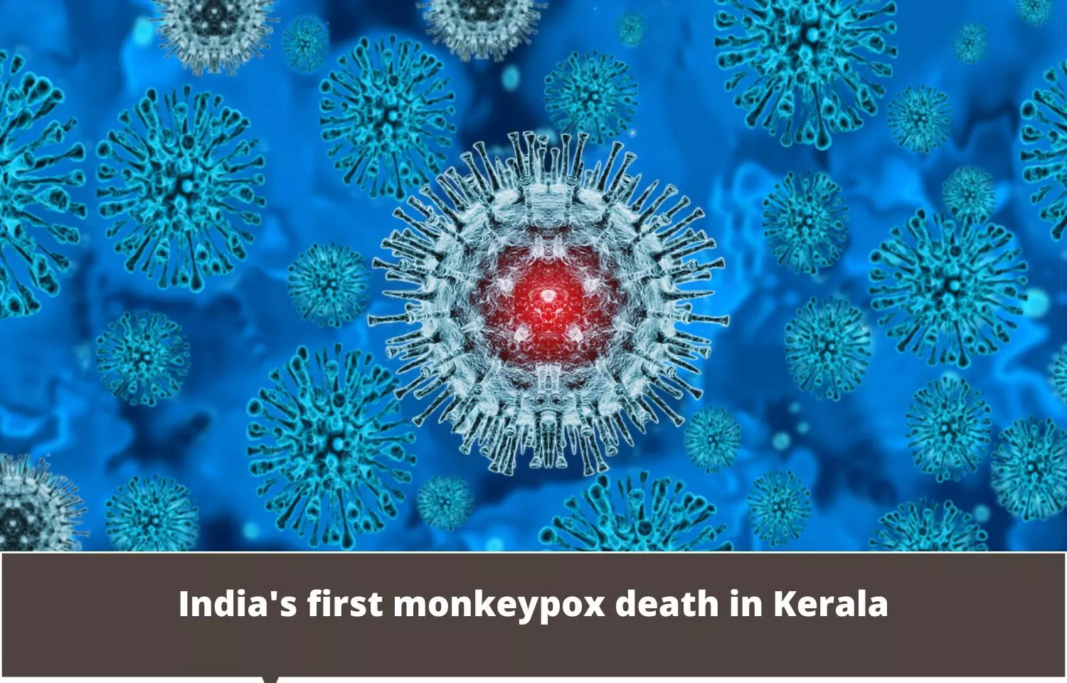 Indias first monkeypox death in Kerala