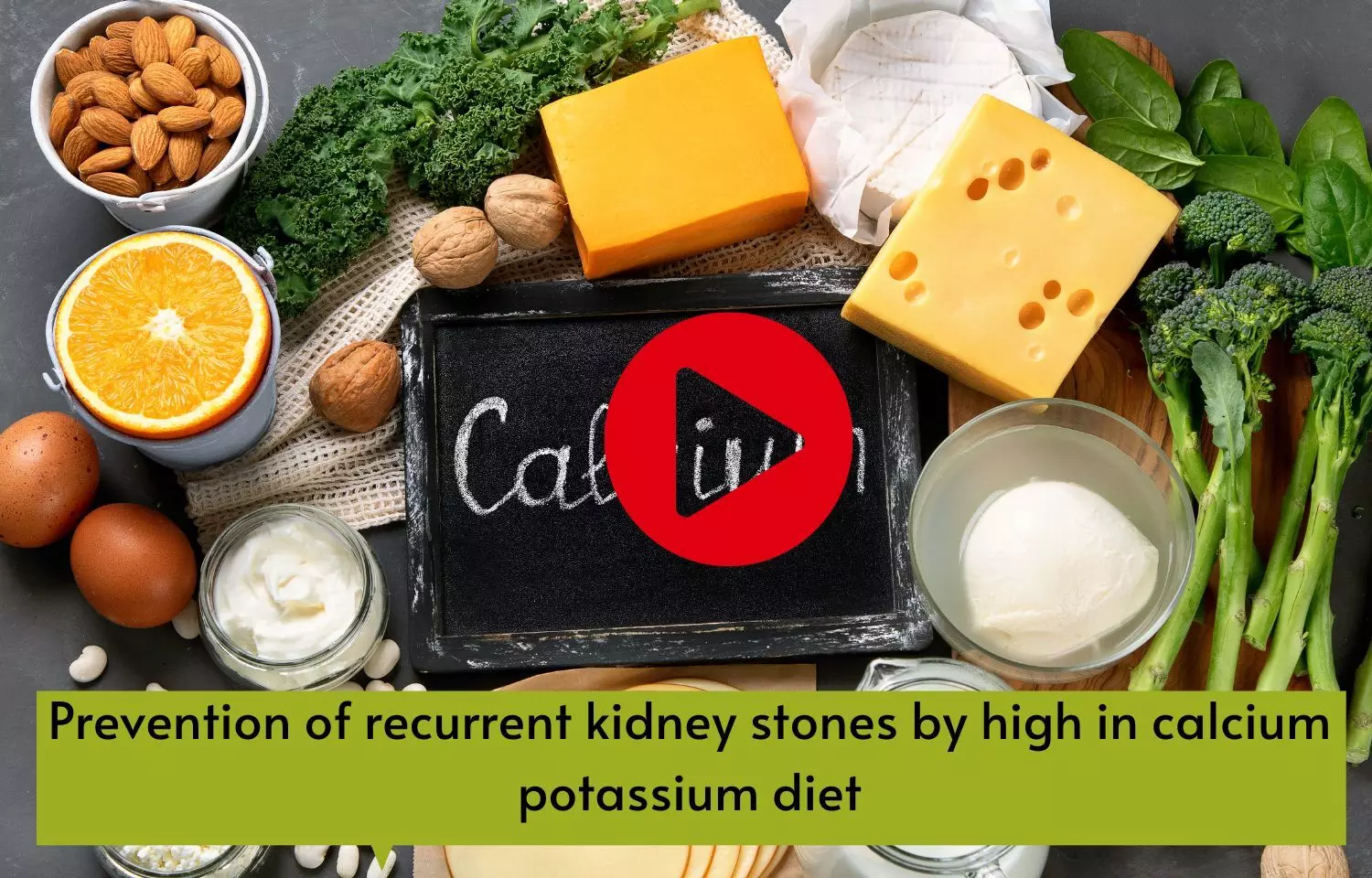 Prevention of recurrent kidney stones by high in calcium potassium diet