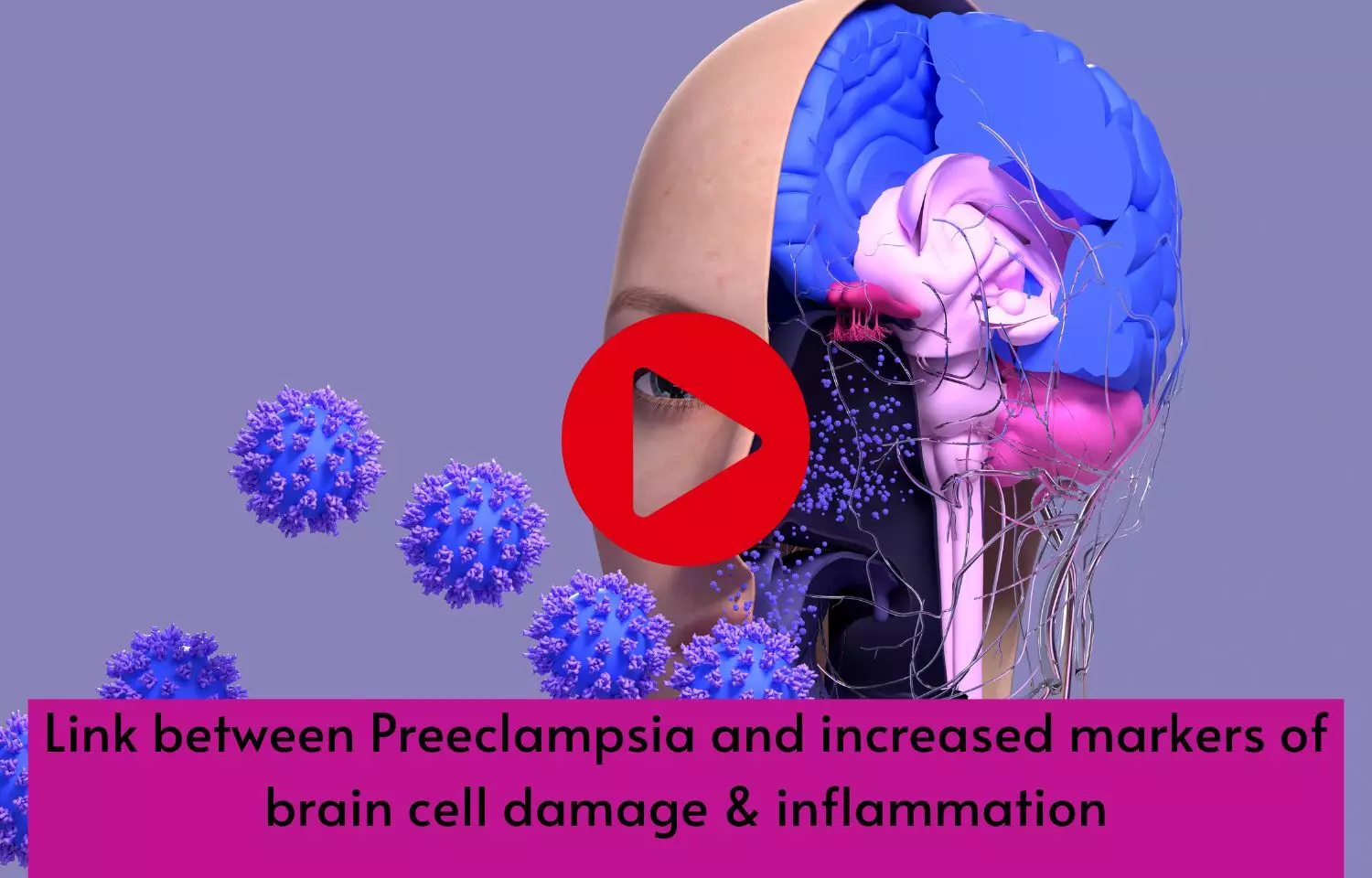 Link between Preeclampsia and increased markers of brain cell damage & inflammation