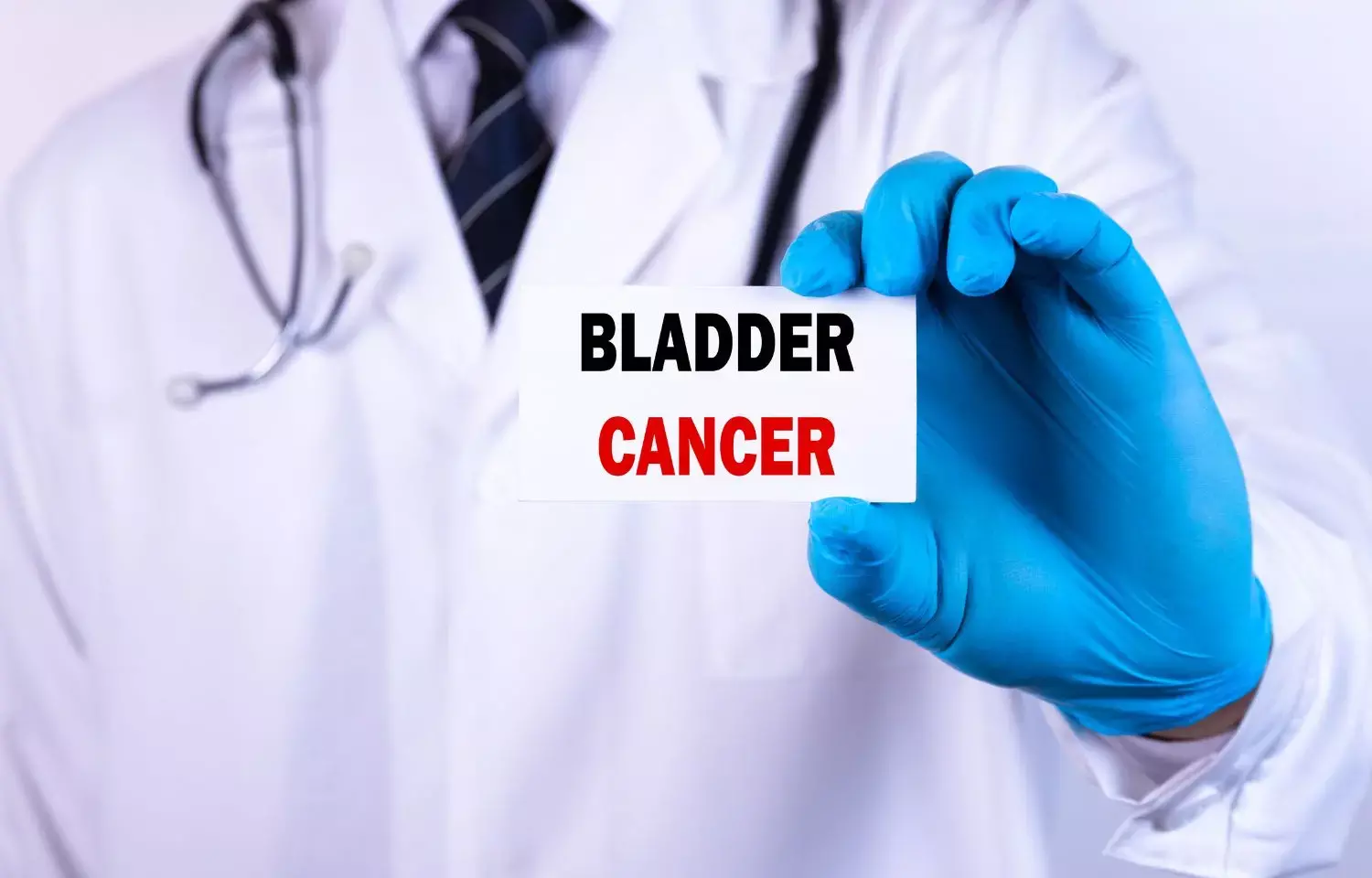 Combining chemotherapy and radiotherapy has long term benefit in bladder cancer