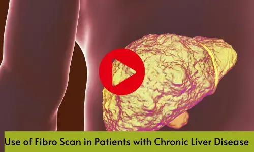 Use of Fibro Scan in Patients with Chronic Liver Disease