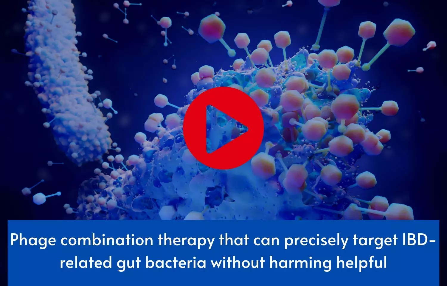 Phage combination therapy that can precisely target IBD-related gut bacteria without harming helpful