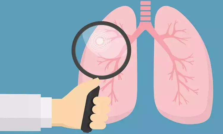Why lung cancer doesnt respond well to immunotherapy