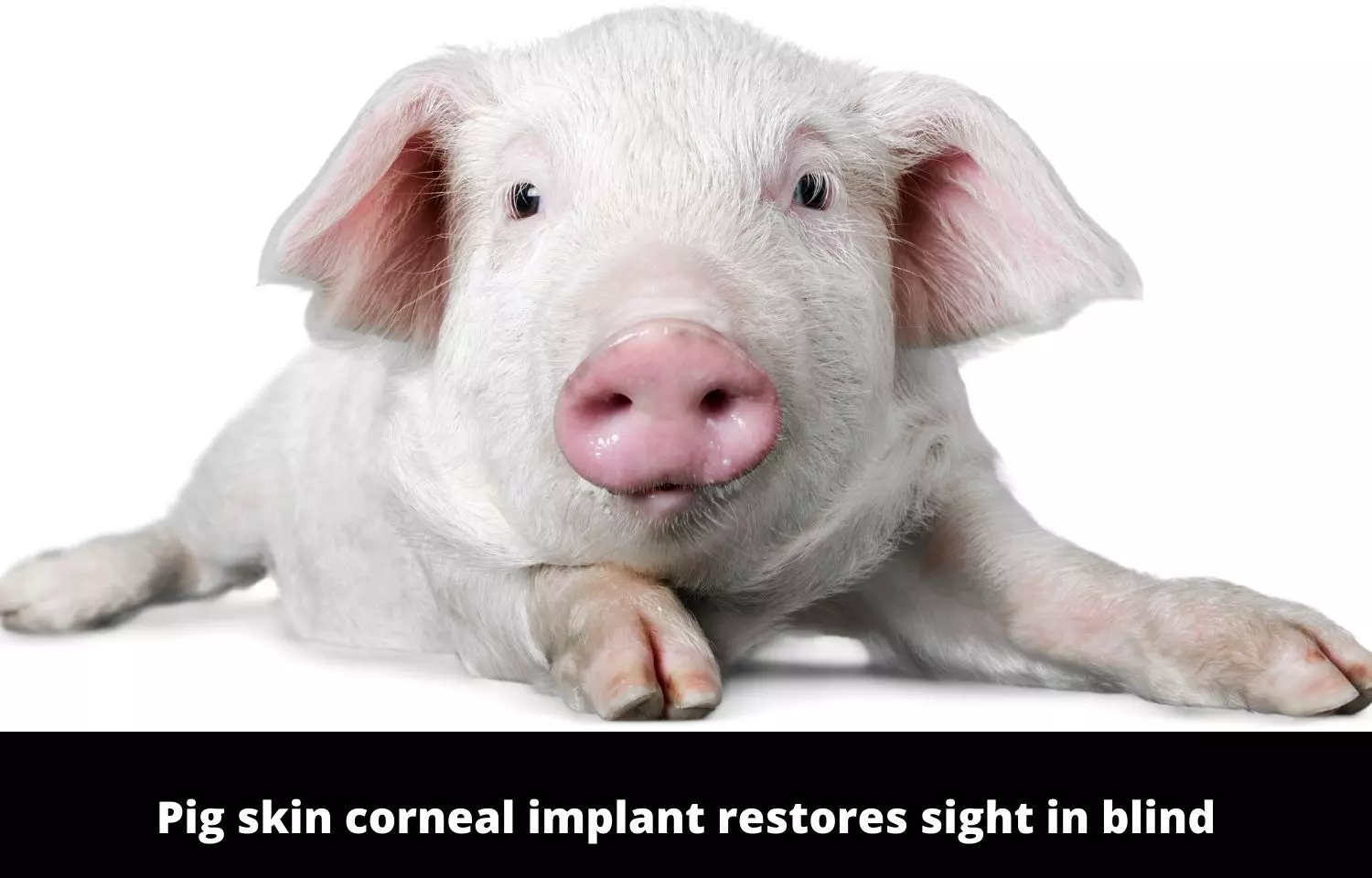 Pig skin corneal implant restores sight in blind, visually impaired