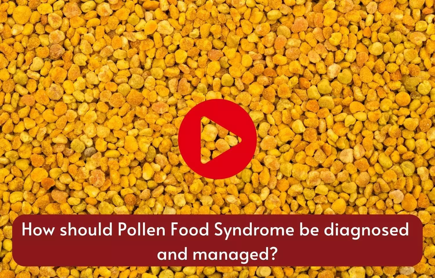 How should Pollen Food Syndrome be diagnosed and managed?