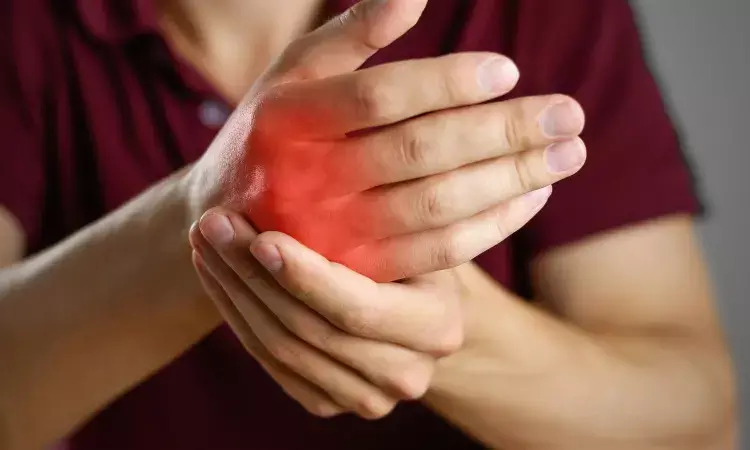 Bimekizumab cost effective treatment option for psoriatic arthritis