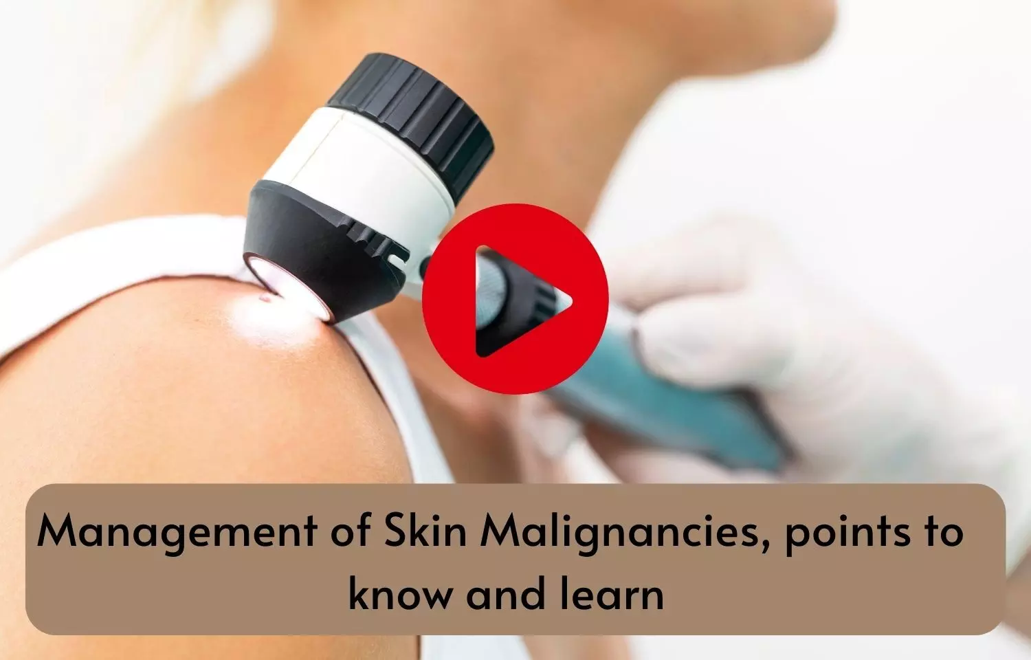 Management of Skin Malignancies, points to know and learn