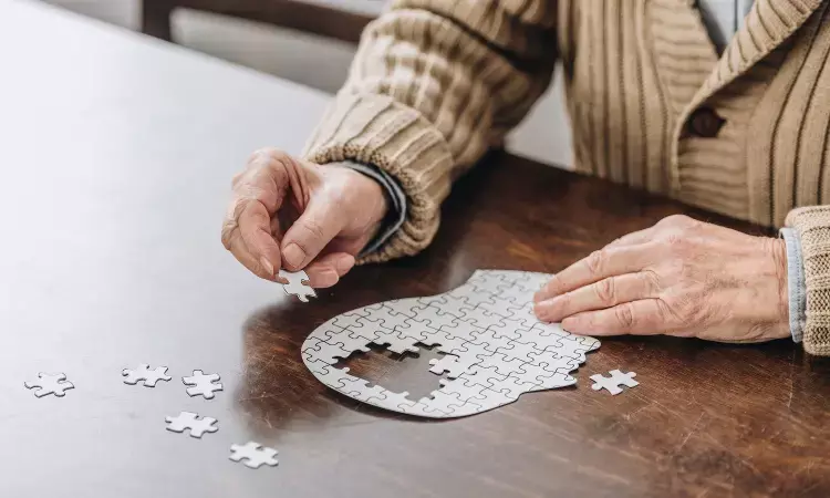 Sedentary Behavior Linked to Increased Risk of Dementia in Older Adults: JAMA