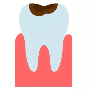 	Dental caries