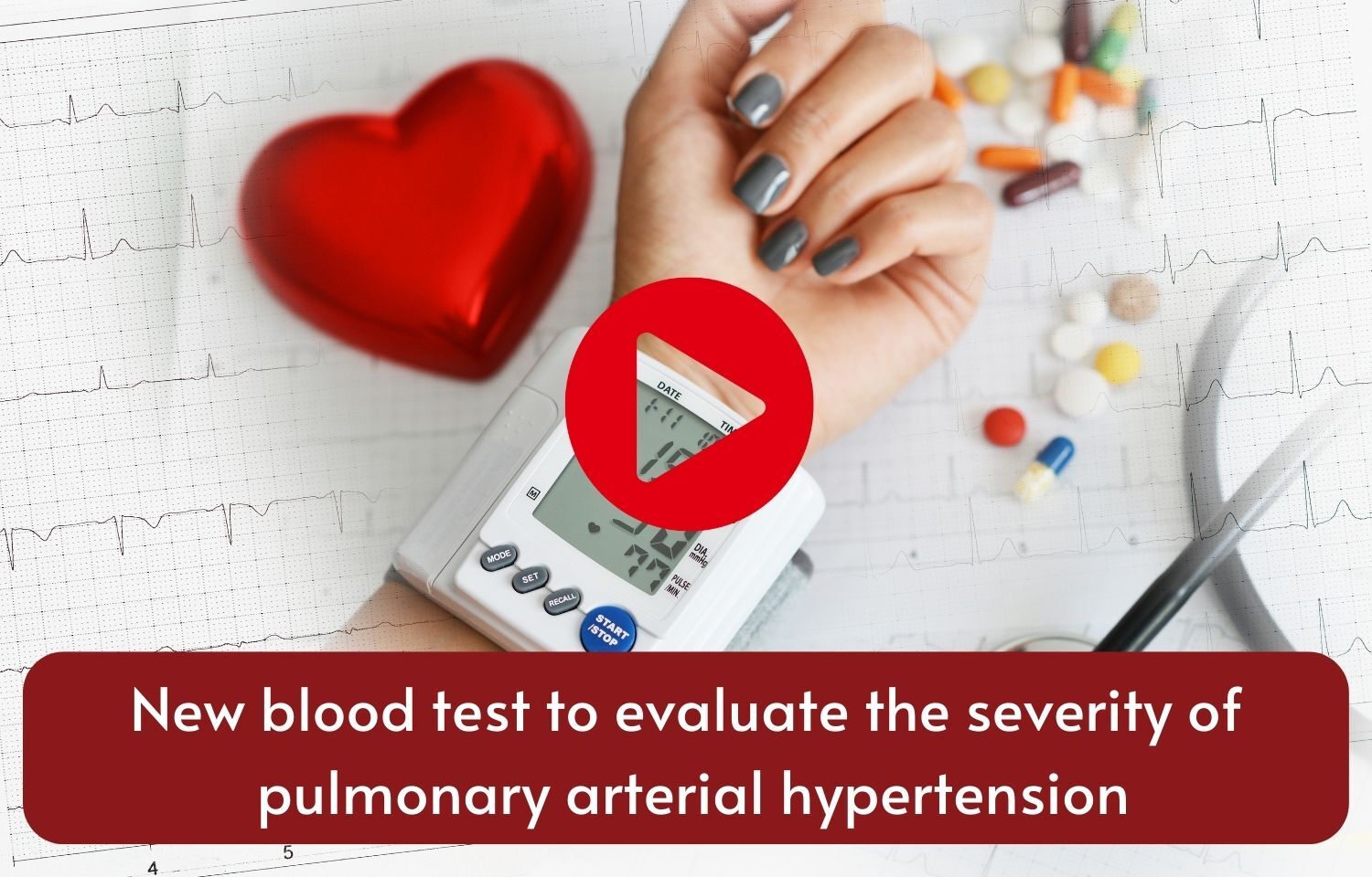 New blood test to evaluate the severity of pulmonary arterial hypertension