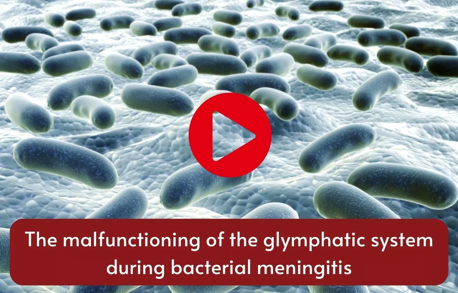 The malfunctioning of the glymphatic system during bacterial meningitis