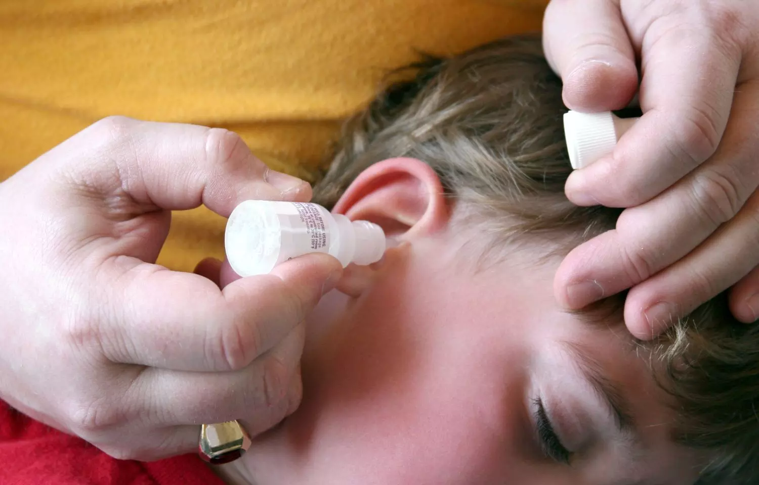 AI model outperforms clinicians in diagnosis of pediatric ear infections