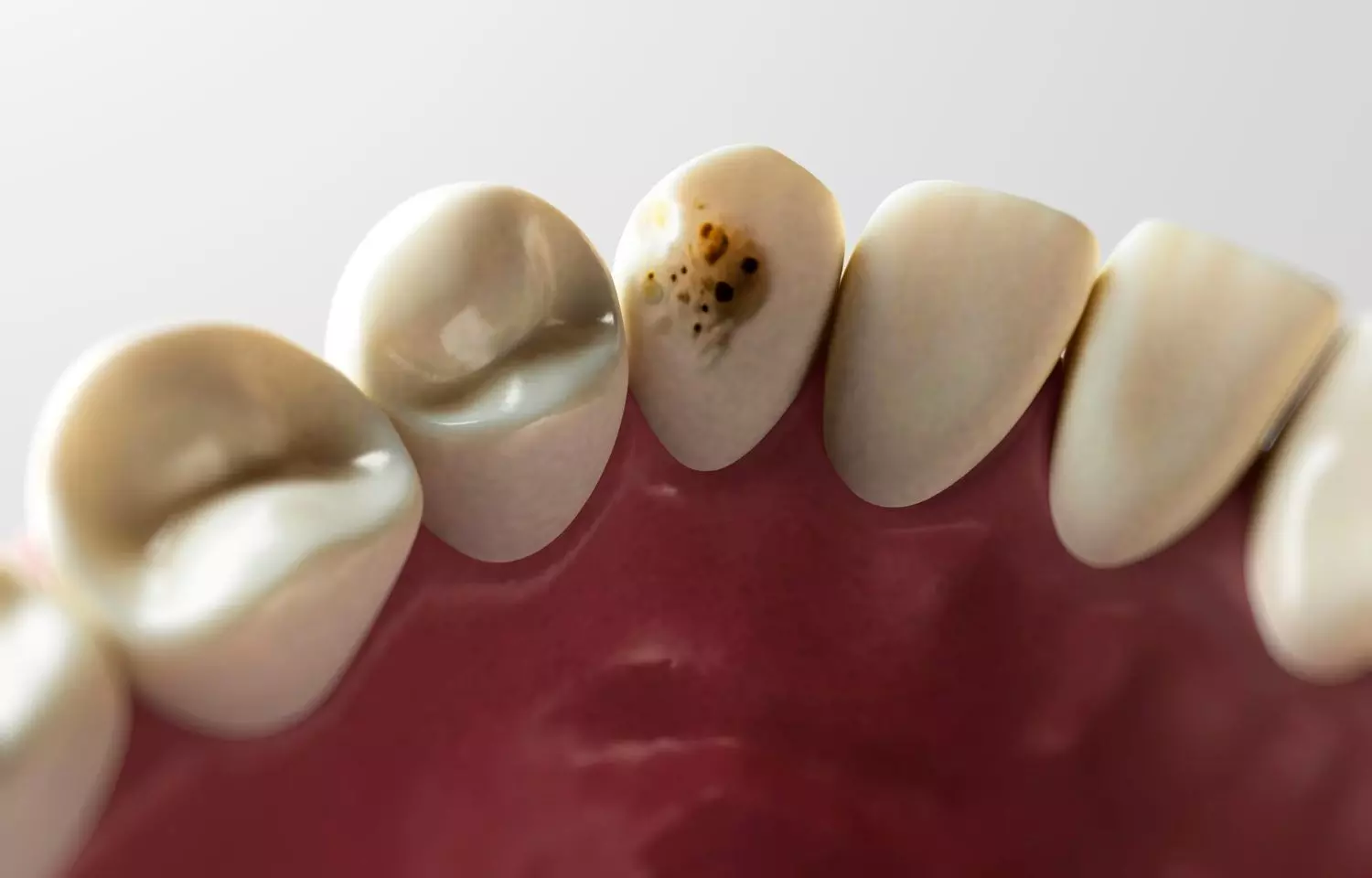 Positive stress may induce good changes in tooth stem cells to boost tooth tissue regeneration