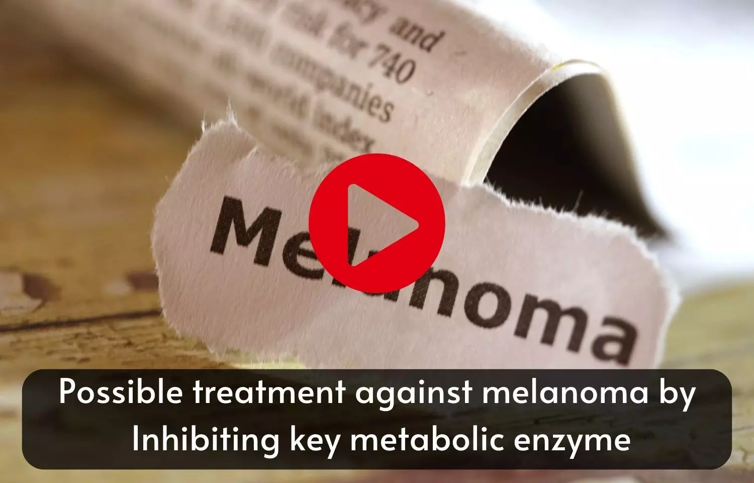 Possible treatment against melanoma by Inhibiting key metabolic enzyme