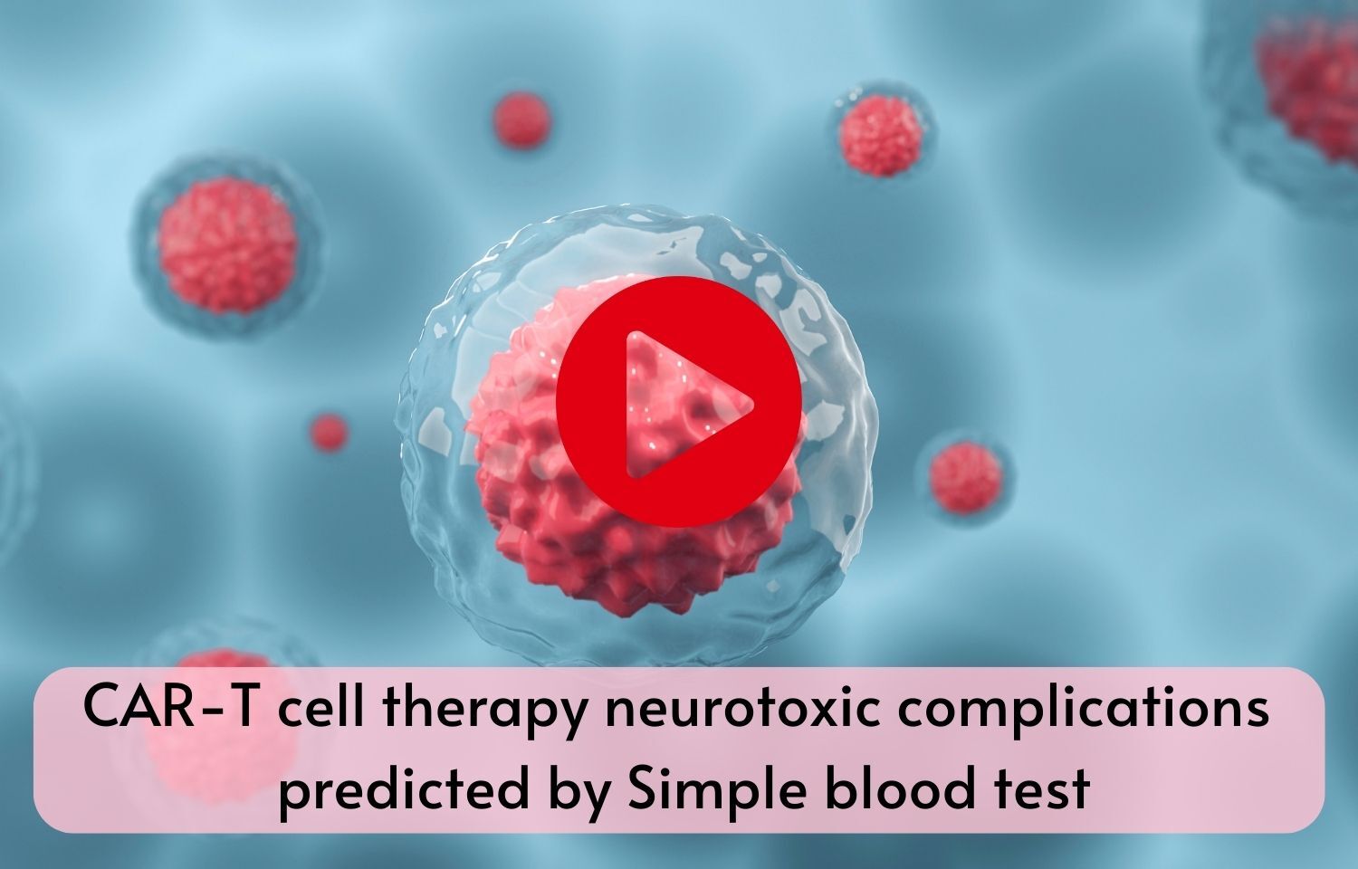 CAR-T cell therapy neurotoxic complications predicted by Simple blood test